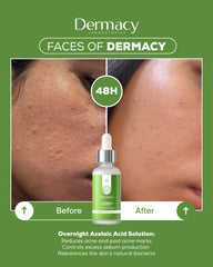 Overnight Azelaic Acid Solution 30ml