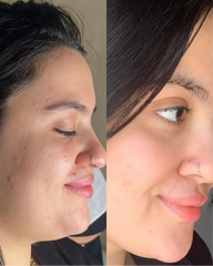 AHA & BHA Peeling Solution 30ml