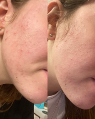 First Aid Kit Bundle